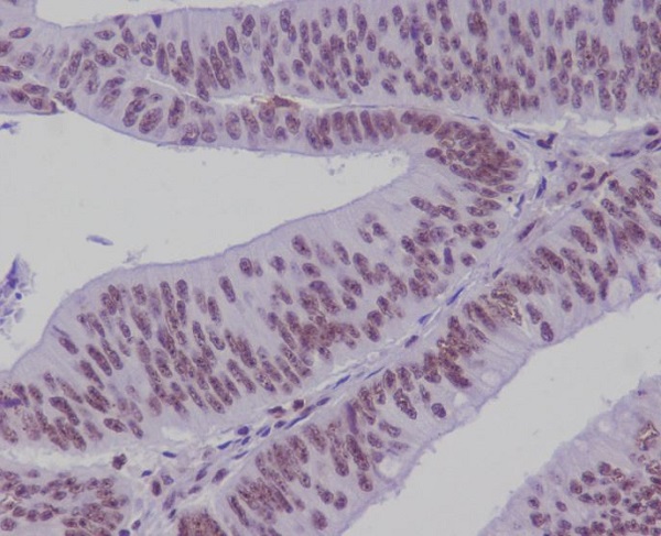 2 - Anti-TCF7L2 Rabbit Monoclonal Antibody ABO13840