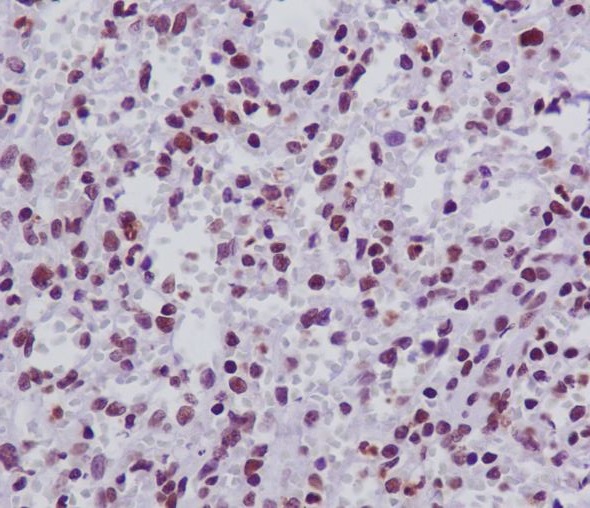 2 - Anti-FANCD2 Rabbit Monoclonal Antibody ABO13842