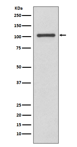1 - Anti-INPP4B/Type Ii 4 Phosphatase Rabbit Monoclonal Antibody ABO13843