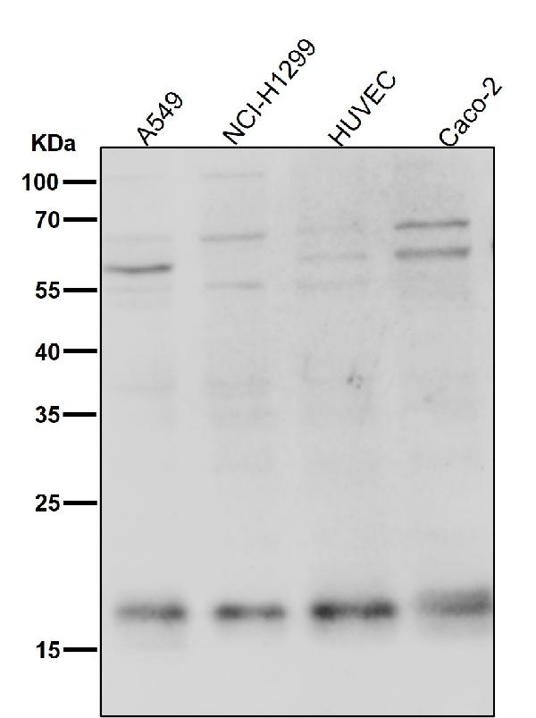 1 - Anti-TWEAKR Rabbit Monoclonal Antibody ABO13844