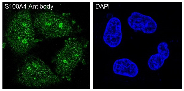 3 - Anti-S100A4 Rabbit Monoclonal Antibody ABO13845