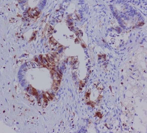 2 - Anti-S100A4 Rabbit Monoclonal Antibody ABO13845