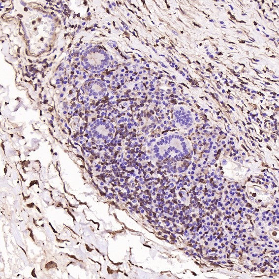 2 - Anti-S100A4 Rabbit Monoclonal Antibody ABO13845