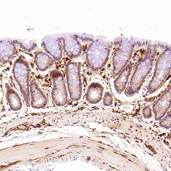 2 - Anti-S100A4 Rabbit Monoclonal Antibody ABO13845