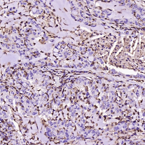 2 - Anti-S100A4 Rabbit Monoclonal Antibody ABO13845