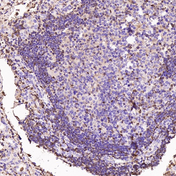 2 - Anti-S100A4 Rabbit Monoclonal Antibody ABO13845
