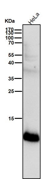 1 - Anti-S100A4 Rabbit Monoclonal Antibody ABO13845