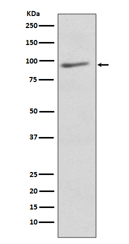 1 - Anti-EIF2C3 AGO3 Rabbit Monoclonal Antibody ABO13846