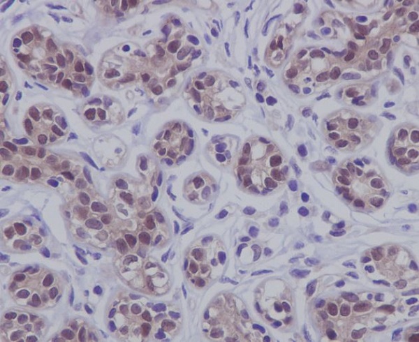 2 - Anti-STAT5b Rabbit Monoclonal Antibody ABO13847