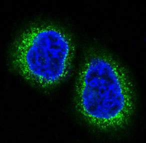 3 - Anti-HDAC10 Rabbit Monoclonal Antibody ABO13848