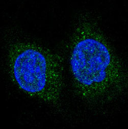 3 - Anti-FoxO3a Rabbit Monoclonal Antibody ABO13849