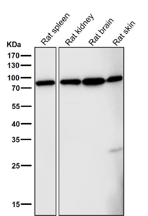 1 - Anti-FoxO3a Rabbit Monoclonal Antibody ABO13849