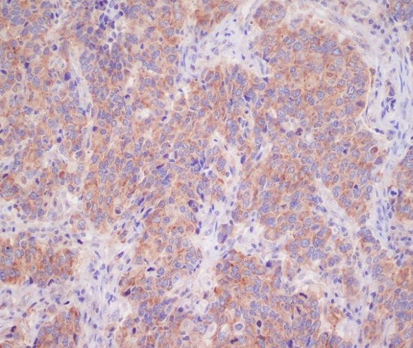 2 - Anti-14-3-3 YWHAB Rabbit Monoclonal Antibody ABO13850