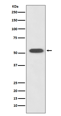 1 - Anti-HSPA14 Rabbit Monoclonal Antibody ABO13852