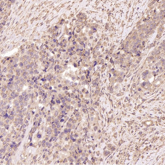 2 - Anti-TSG101 Rabbit Monoclonal Antibody ABO13857