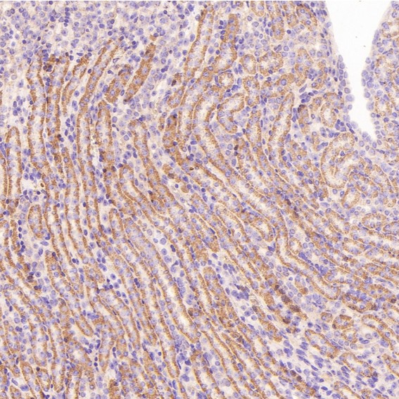 2 - Anti-TSG101 Rabbit Monoclonal Antibody ABO13857
