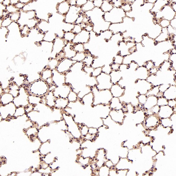 2 - Anti-TSG101 Rabbit Monoclonal Antibody ABO13857