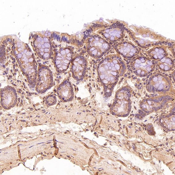 2 - Anti-TSG101 Rabbit Monoclonal Antibody ABO13857