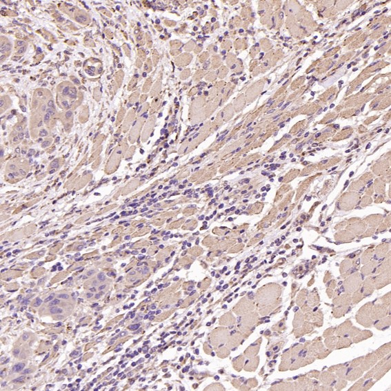 2 - Anti-TSG101 Rabbit Monoclonal Antibody ABO13857