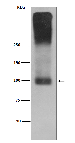 1 - Anti-mGluR2 GRM2 Rabbit Monoclonal Antibody ABO13859