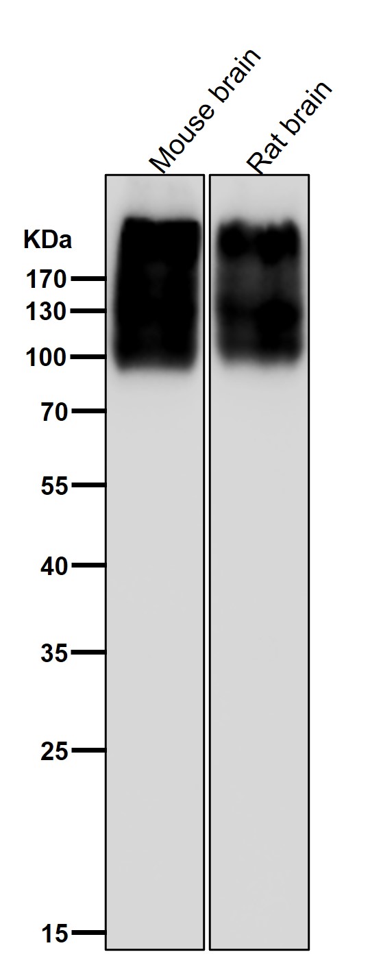 1 - Anti-mGluR2 GRM2 Rabbit Monoclonal Antibody ABO13859