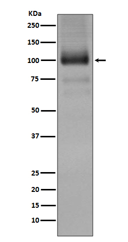 1 - Anti-mGluR1 GRM1 Rabbit Monoclonal Antibody ABO13860