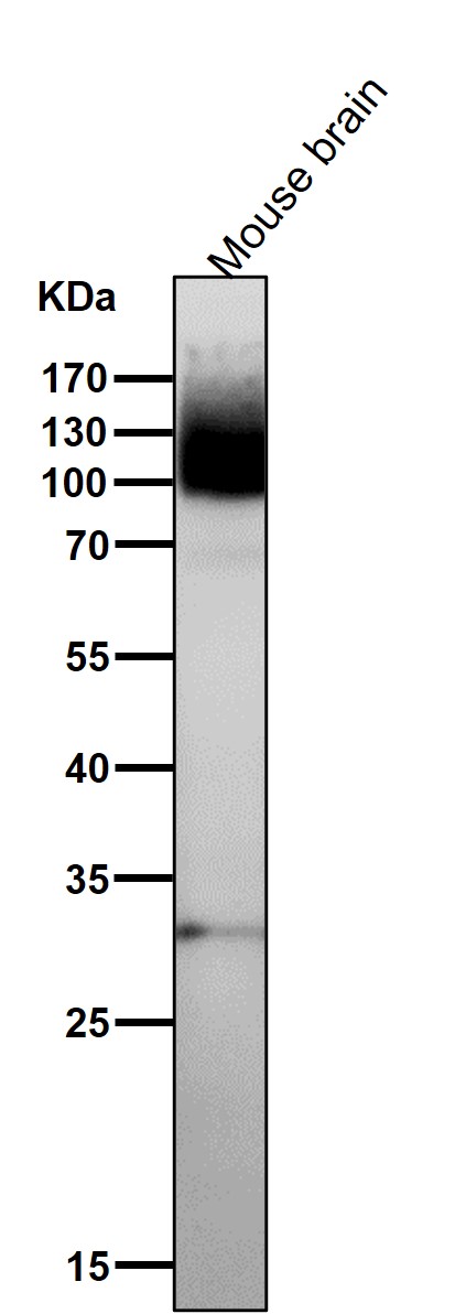 1 - Anti-mGluR1 GRM1 Rabbit Monoclonal Antibody ABO13860