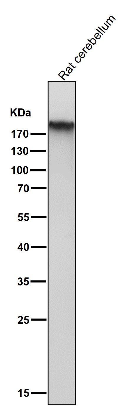 1 - Anti-mGluR1 GRM1 Rabbit Monoclonal Antibody ABO13860