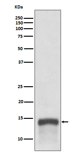 1 - Anti-S100A9 Rabbit Monoclonal Antibody ABO13861
