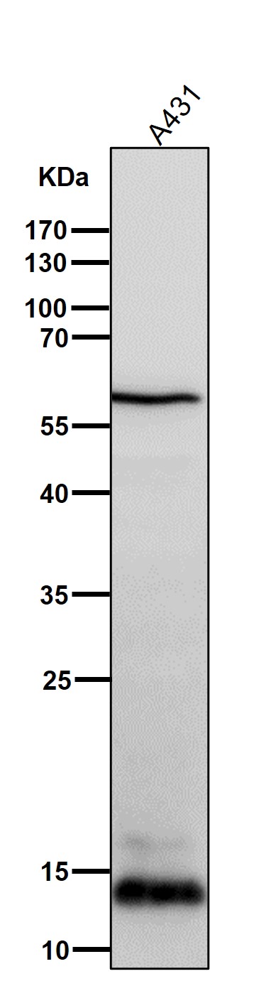 1 - Anti-S100A9 Rabbit Monoclonal Antibody ABO13861