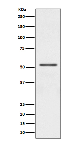 1 - Anti-Parkin PARK2 Rabbit Monoclonal Antibody ABO13862