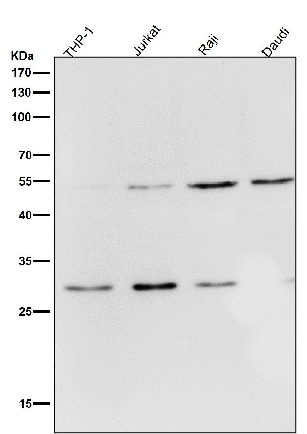 1 - Anti-Parkin PARK2 Rabbit Monoclonal Antibody ABO13862