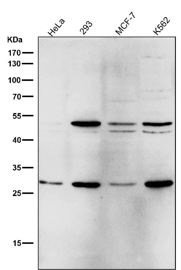 1 - Anti-Parkin PARK2 Rabbit Monoclonal Antibody ABO13862