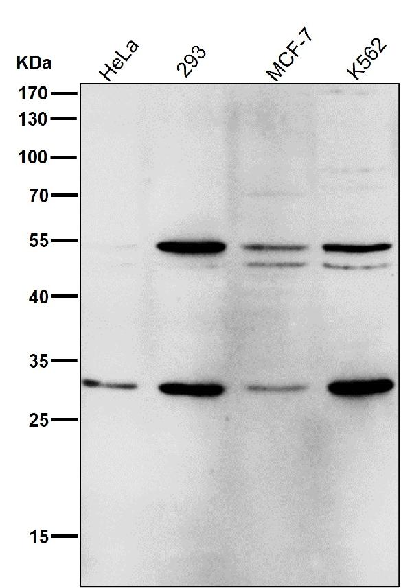 1 - Anti-Parkin PARK2 Rabbit Monoclonal Antibody ABO13862