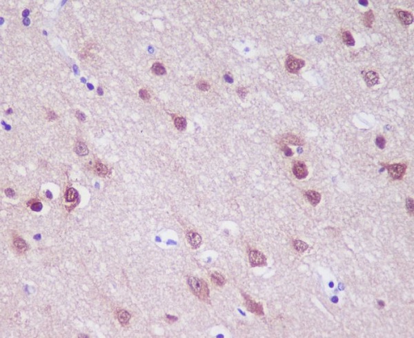 2 - Anti-PGP9.5 Rabbit Monoclonal Antibody ABO13863
