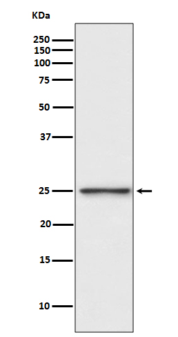 1 - Anti-PGP9.5 Rabbit Monoclonal Antibody ABO13863