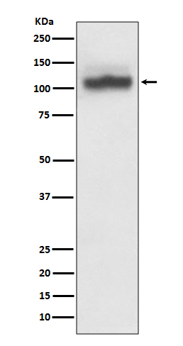 1 - Anti-SERCA2 ATP2A2 Rabbit Monoclonal Antibody ABO13864