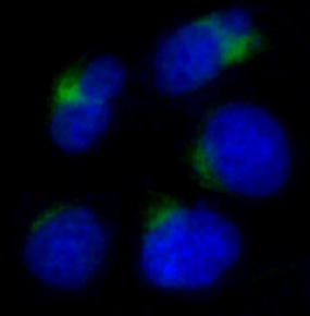 3 - Anti-ADAM17/Tace Rabbit Monoclonal Antibody ABO13866