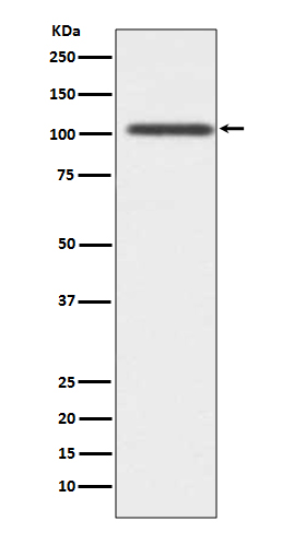 1 - Anti-ADAM17/Tace Rabbit Monoclonal Antibody ABO13866