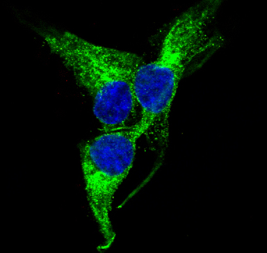 3 - Anti-PGP9.5 UCHL1 Rabbit Monoclonal Antibody ABO13868