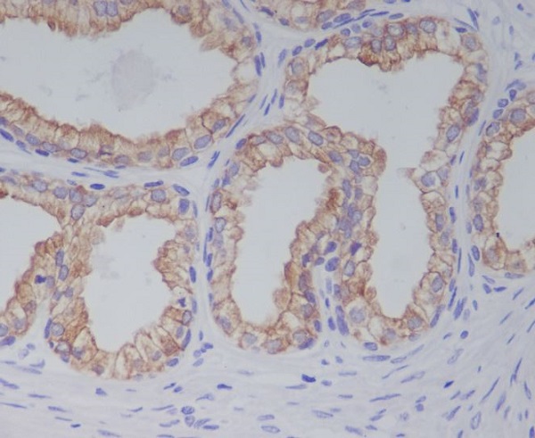 2 - Anti-PGP9.5 UCHL1 Rabbit Monoclonal Antibody ABO13868