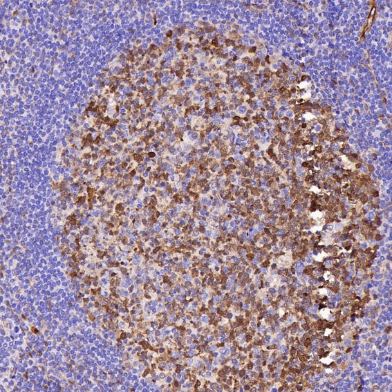 2 - Anti-PGP9.5 UCHL1 Rabbit Monoclonal Antibody ABO13868