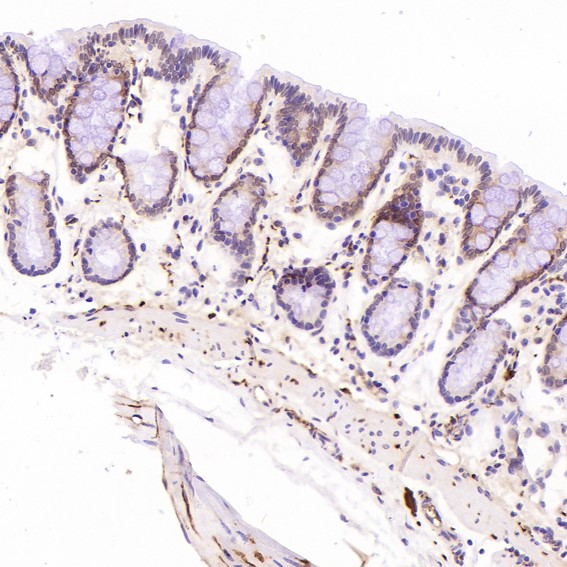 2 - Anti-PGP9.5 UCHL1 Rabbit Monoclonal Antibody ABO13868