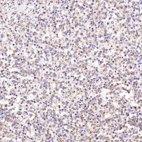 2 - Anti-PGP9.5 UCHL1 Rabbit Monoclonal Antibody ABO13868