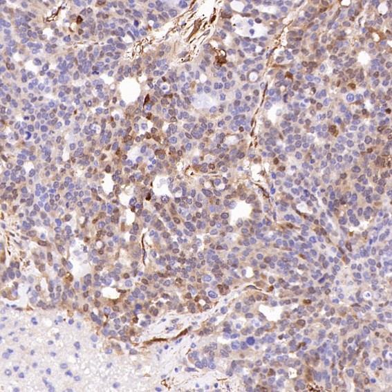 2 - Anti-PGP9.5 UCHL1 Rabbit Monoclonal Antibody ABO13868