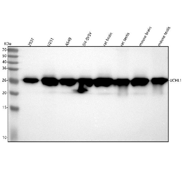 1 - Anti-PGP9.5 UCHL1 Rabbit Monoclonal Antibody ABO13868