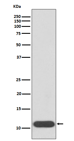1 - Anti-HBG1/2 Rabbit Monoclonal Antibody ABO13869