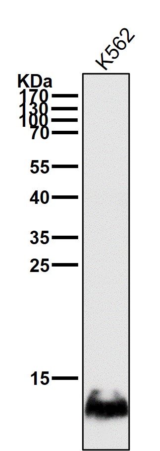 1 - Anti-HBG1/2 Rabbit Monoclonal Antibody ABO13869
