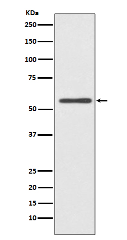 1 - Anti-CYP2E1 Rabbit Monoclonal Antibody ABO13870