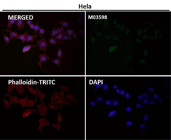 1 - Anti-ATP5A1/Atp5A Rabbit Monoclonal Antibody ABO13871